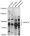 Cytoplasmic dynein 1 intermediate chain 2 antibody, 15-686, ProSci, Western Blot image 