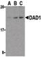 Defender Against Cell Death 1 antibody, PA5-20062, Invitrogen Antibodies, Western Blot image 
