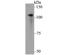 ADAP antibody, NBP2-76882, Novus Biologicals, Western Blot image 