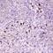 RNS3 antibody, A03115-1, Boster Biological Technology, Immunohistochemistry paraffin image 