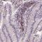 Scm Polycomb Group Protein Like 4 antibody, PA5-66812, Invitrogen Antibodies, Immunohistochemistry paraffin image 