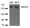 BRCA1 DNA Repair Associated antibody, A00005-1, Boster Biological Technology, Western Blot image 
