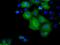 Potassium Channel Tetramerization Domain Containing 5 antibody, MA5-25069, Invitrogen Antibodies, Immunocytochemistry image 