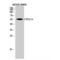 Cytochrome P450 Family 2 Subfamily C Member 19 antibody, LS-C383003, Lifespan Biosciences, Western Blot image 