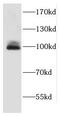 Eukaryotic Translation Initiation Factor 4 Gamma 2 antibody, FNab02239, FineTest, Western Blot image 