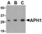 Gamma-secretase subunit APH-1A antibody, MBS150469, MyBioSource, Western Blot image 