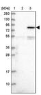 Serine/threonine-protein kinase Nek8 antibody, PA5-59248, Invitrogen Antibodies, Western Blot image 