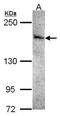 Serine/Threonine Kinase 36 antibody, GTX108794, GeneTex, Western Blot image 