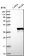 Homeobox A5 antibody, HPA029319, Atlas Antibodies, Western Blot image 