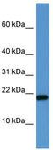 SH2 Domain Containing 1A antibody, TA342926, Origene, Western Blot image 