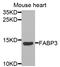 Fatty Acid Binding Protein 3 antibody, STJ27265, St John