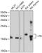Jumping Translocation Breakpoint antibody, 13-641, ProSci, Western Blot image 