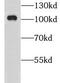 Glutamate receptor 4 antibody, FNab03646, FineTest, Western Blot image 