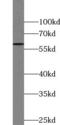 Torsin 1A Interacting Protein 2 antibody, FNab08872, FineTest, Western Blot image 