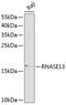 Ribonuclease A Family Member 13 (Inactive) antibody, GTX54675, GeneTex, Western Blot image 