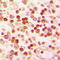Paired Box 1 antibody, GTX56136, GeneTex, Immunohistochemistry paraffin image 