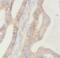 HDGF Like 2 antibody, FNab04012, FineTest, Immunohistochemistry paraffin image 