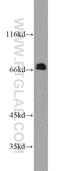 Calpain 6 antibody, 10120-1-AP, Proteintech Group, Western Blot image 