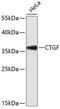 Connective tissue growth factor antibody, 14-203, ProSci, Western Blot image 