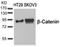CTNNB1 antibody, AP02722PU-S, Origene, Western Blot image 