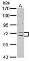 Zinc Finger Protein 182 antibody, LS-C155491, Lifespan Biosciences, Western Blot image 