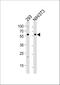 Bone Morphogenetic Protein Receptor Type 1A antibody, A01581, Boster Biological Technology, Western Blot image 