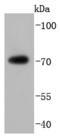 FUS RNA Binding Protein antibody, A00771-2, Boster Biological Technology, Western Blot image 