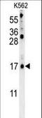 Late Cornified Envelope 2B antibody, LS-C165715, Lifespan Biosciences, Western Blot image 