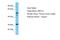 Zinc Finger Protein 514 antibody, A16414, Boster Biological Technology, Western Blot image 