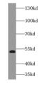 ZIPK antibody, FNab09644, FineTest, Western Blot image 