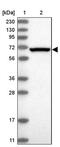 Eukaryotic Translation Initiation Factor 2A antibody, PA5-57587, Invitrogen Antibodies, Western Blot image 