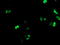 Mtg8 antibody, M01792, Boster Biological Technology, Immunofluorescence image 