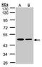 Endoplasmic Reticulum Protein 44 antibody, GTX106636, GeneTex, Western Blot image 