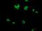 Cytochrome c oxidase subunit 6B2 antibody, NBP2-02729, Novus Biologicals, Immunocytochemistry image 