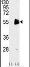 Protein Arginine Methyltransferase 7 antibody, PA5-11126, Invitrogen Antibodies, Western Blot image 