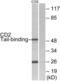CD2 Cytoplasmic Tail Binding Protein 2 antibody, LS-C119434, Lifespan Biosciences, Western Blot image 