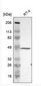 Zinc Finger FYVE-Type Containing 1 antibody, NBP1-84267, Novus Biologicals, Western Blot image 