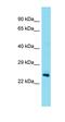 Testis Expressed 36 antibody, orb326919, Biorbyt, Western Blot image 