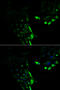 Hyaluronan Binding Protein 2 antibody, MBS9125179, MyBioSource, Immunofluorescence image 