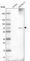 Zinc Finger DHHC-Type Containing 17 antibody, PA5-53492, Invitrogen Antibodies, Western Blot image 