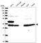 SPG21 Abhydrolase Domain Containing, Maspardin antibody, HPA040407, Atlas Antibodies, Western Blot image 