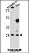Eukaryotic Translation Initiation Factor 4H antibody, 56-537, ProSci, Western Blot image 