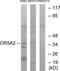 Olfactory Receptor Family 5 Subfamily A Member 2 antibody, TA316244, Origene, Western Blot image 