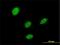 LIM Homeobox 5 antibody, H00064211-M04, Novus Biologicals, Immunofluorescence image 