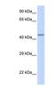 Zinc Finger Protein 589 antibody, NBP1-80275, Novus Biologicals, Western Blot image 