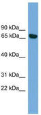 Protein kinase C iota type antibody, TA342150, Origene, Western Blot image 
