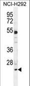 BAF Chromatin Remodeling Complex Subunit BCL7A antibody, LS-C156778, Lifespan Biosciences, Western Blot image 