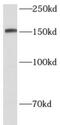 Semaphorin 4D antibody, FNab10114, FineTest, Western Blot image 