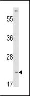 pVHL antibody, PA5-13487, Invitrogen Antibodies, Western Blot image 