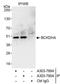 Branched Chain Keto Acid Dehydrogenase E1 Subunit Alpha antibody, A303-790A, Bethyl Labs, Immunoprecipitation image 